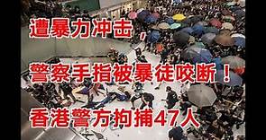 遭暴力冲击，警察手指被暴徒咬断！香港警方拘捕47人