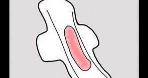 3 Preguntas frecuentes sobre el flujo vaginal rosa