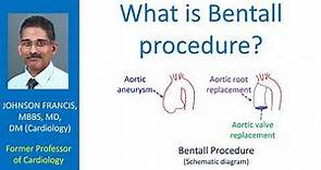 What is Bentall procedure?