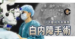 白内障手術 cataract surgery 小沢眼科内科病院 茨城県 水戸市 眼科