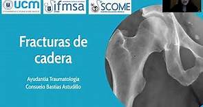 Fracturas de Cadera - Traumatología 2 - Reforzamiento Académico UCM