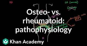 Osteoarthritis vs rheumatoid arthritis pathophysiology | NCLEX-RN | Khan Academy