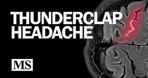 Thunderclap Headache