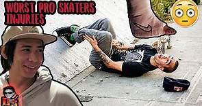 TOP 5 Las Peores Lesiones de Skaters Pro | Worst Injuries