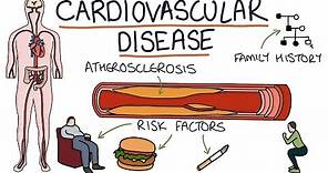 Understanding Cardiovascular Disease: Visual Explanation for Students
