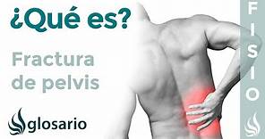 FRACTURA de PELVIS | Qué es, síntomas, signos clínicos, causas y tratamiento fisioterapéutico