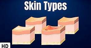Skin Types: Everything You Need To Know