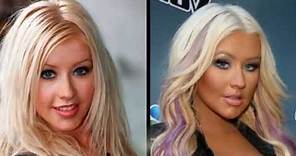 49 Celebrities Before and After Plastic Surgery