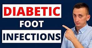 Diabetic Foot Infections: Treatment
