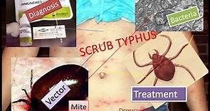 Scrub typhus symptoms, diagnosis and protection