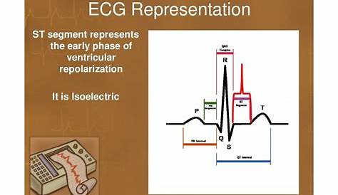 Basics of ECG