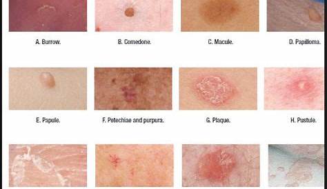 skin lesion description chart