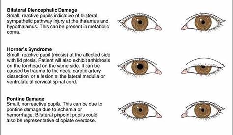 Normal Pupil Size Chart: Understanding Your Eye Health - Dona