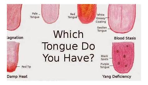 What your tongue can tell you about your Health Problems – 7 Warning