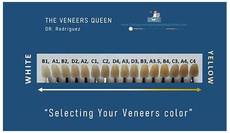 white veneer color chart