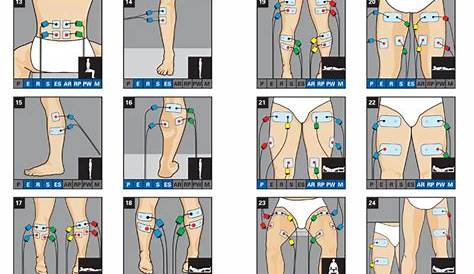 ems electrode placement chart pdf