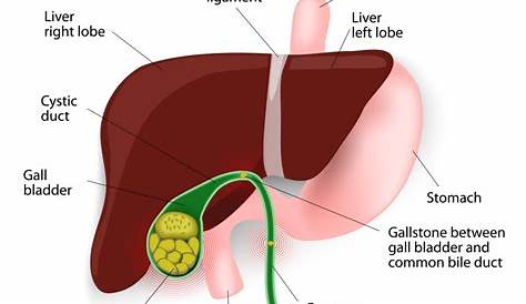 Gall stones & Gall bladder Surgery | Victorian Specialist Surgery