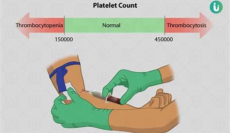 Platelet Count: Procedure, Purpose, Results, Normal range, Cost, Price