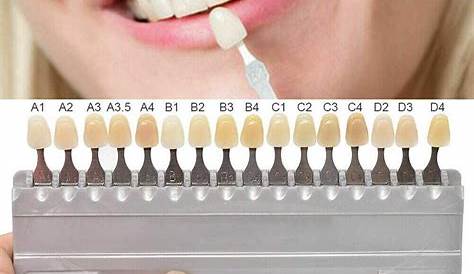 CreazyBee 1 Set 16 Colors 3D Teeth Whitening Shade Guide Porcelain