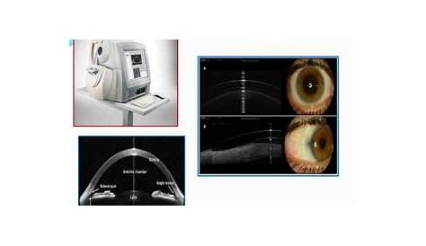 corneal Pachymetry | PPT