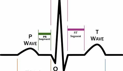 Understanding the EKG Signal - Atrial Fibrillation: Resources for Patients