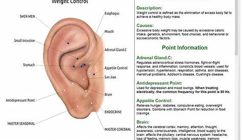 placement of ear seeds for weight loss