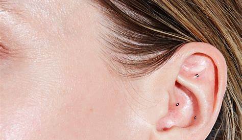 where to place acupuncture ear seeds