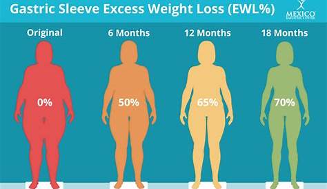 gastric sleeve average weight loss chart