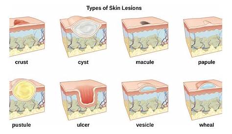 skin lesion flow chart