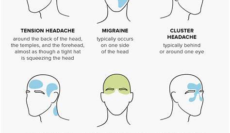 Headache chart: Types by symptoms, location, and causes