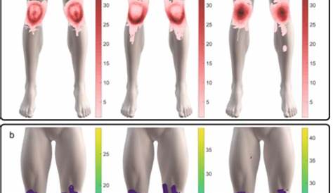 3 Patterns of Knee Pain May Help Identify the Cause | American Council