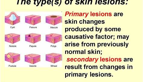 skin lesion description chart