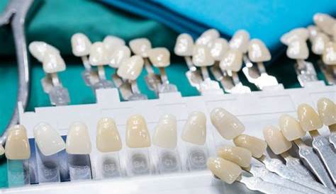 DENTAL SERVICES – Ceramco Dental Clinic
