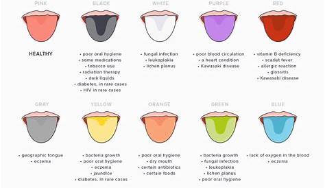 Tongue color: What does it say about health?