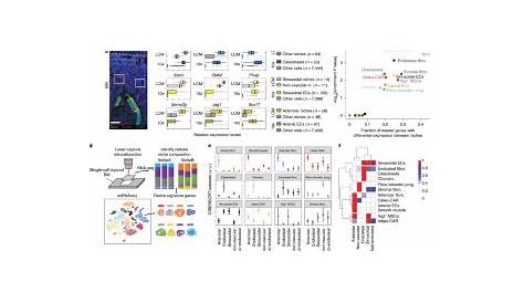 Combined single-cell and spatial transcriptomics reveal the molecular