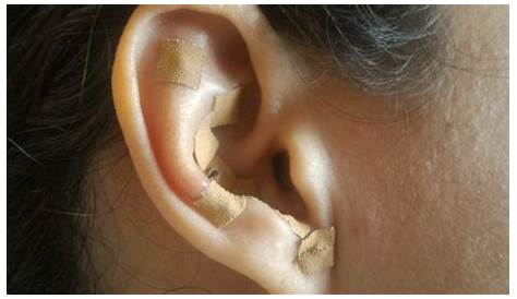 how to use ear seeds