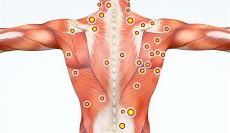 Trigger Points and Pain: | Fast Relief Acupuncture Franklin Lakes, NJ