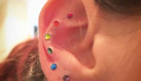 ear seeds for tinnitus
