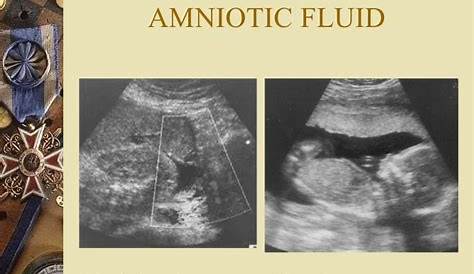 Amniotic fluid