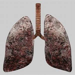 Ugly Lungs