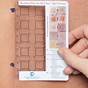 Allergy Patch Test Results Chart