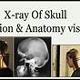 X Ray Positioning Chart With Images Pdf