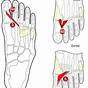 Top Foot Pain Chart
