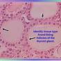 Epithelial Tissue Easy Diagram