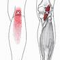 Foot Trigger Points Chart