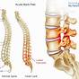 Back Pain Anatomy Chart