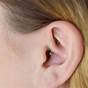 Ear Piercing For Anxiety And Depression