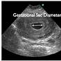 Gestational Sac Size Chart In Mm