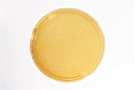 Sabouraud Dextrose Agar Settle Plate- Long incubation