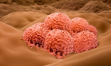 Scientists make huge breakthrough in understanding what causes skin ...